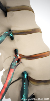 side-spine